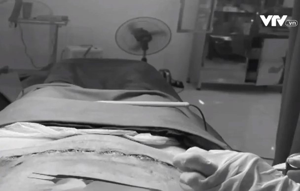 Tiền mất, tật mang vì thẩm mỹ chui”-1