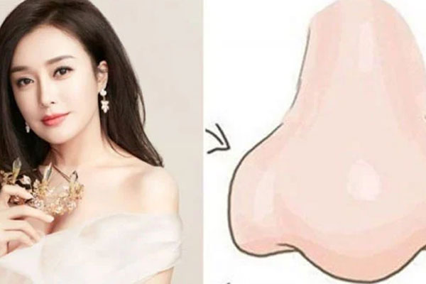 Phụ nữ có 5 chỗ xấu ma chê quỷ hờn” nhưng chồng lại yêu mê mệt, không thèm bồ bịch ngoại tình-3