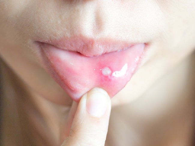 4 dấu hiệu lạ khi thức dậy cảnh báo cơ thể đang thiếu vitamin B12, cần bổ sung gấp kẻo rối loạn nội tiết-4