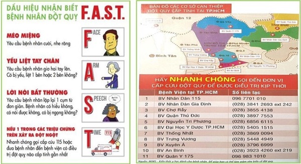 Suýt đột quỵ ở tuổi 30, người trẻ cần làm gì để phòng bệnh?-2