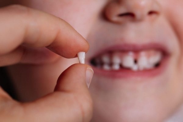 Đừng vội vứt răng sữa của con khi rụng, đây có thể là đảm bảo y tế cho bé trong tương lai-2