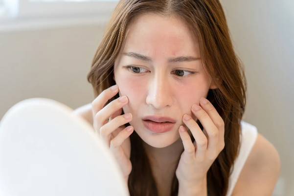 Da nhạy cảm nên chăm sóc thế nào?-1