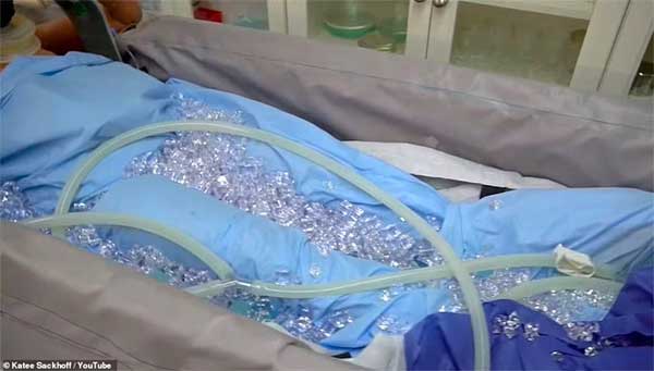 Chi phí đắt đỏ để đông lạnh thi thể chờ ngày sống lại-5