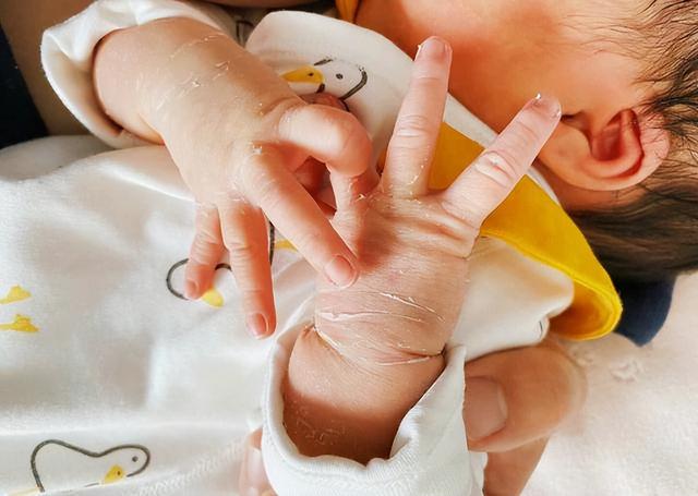 Những biểu hiện lạ này của bé không phải là bệnh, bố mẹ đừng vội cho bé đi bệnh viện-3