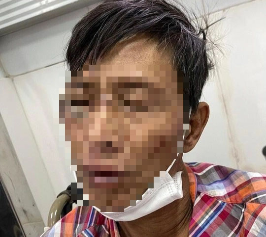 Người đàn ông nhiễm HIV đâm trọng thương người dân, vung rìu chống trả công an-1