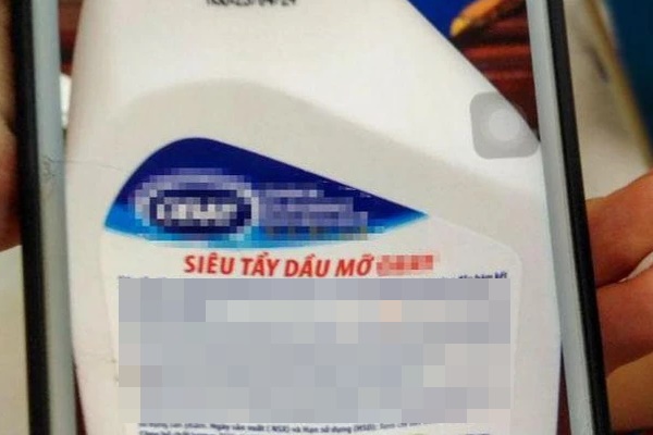 Bé gái 19 tháng tuổi bỏng nặng vì lọ dung dịch hầu hết nhà nào cũng có-1