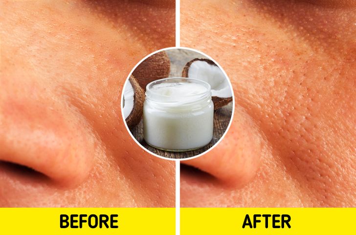 6 quan điểm chăm sóc da phổ biến nhưng lại sai lầm tai hại-4