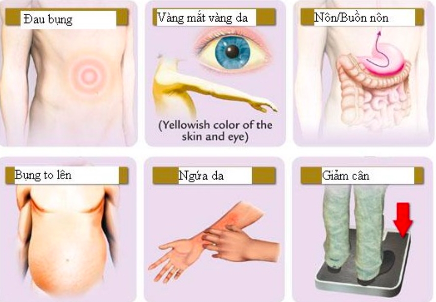Hai tuần liên tục có biểu hiện này, cần khám ngay để phát hiện sớm ung thư gan-2