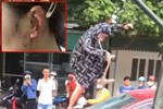 Điều tra vụ đánh ghen khiến cô gái bị cắn đứt 1 phần tai ở Thanh Hoá