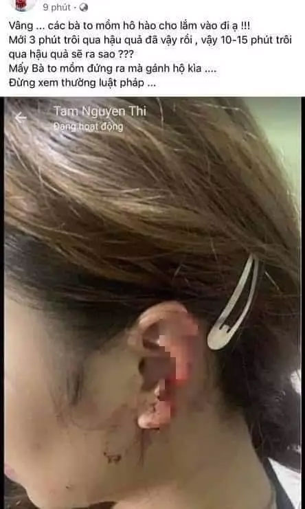 Điều tra vụ đánh ghen khiến cô gái bị cắn đứt 1 phần tai ở Thanh Hoá-2