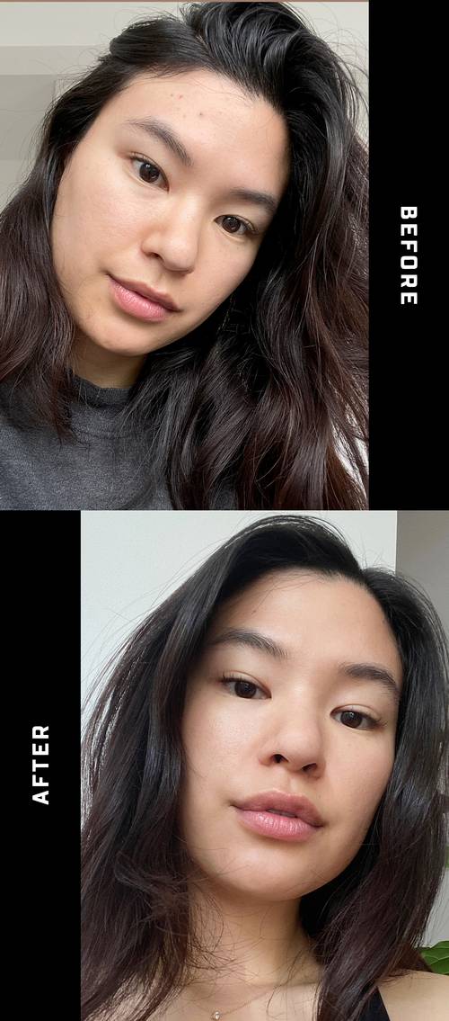 Sự thay đổi của làn da khi chăm dùng vitamin C mỗi ngày-2