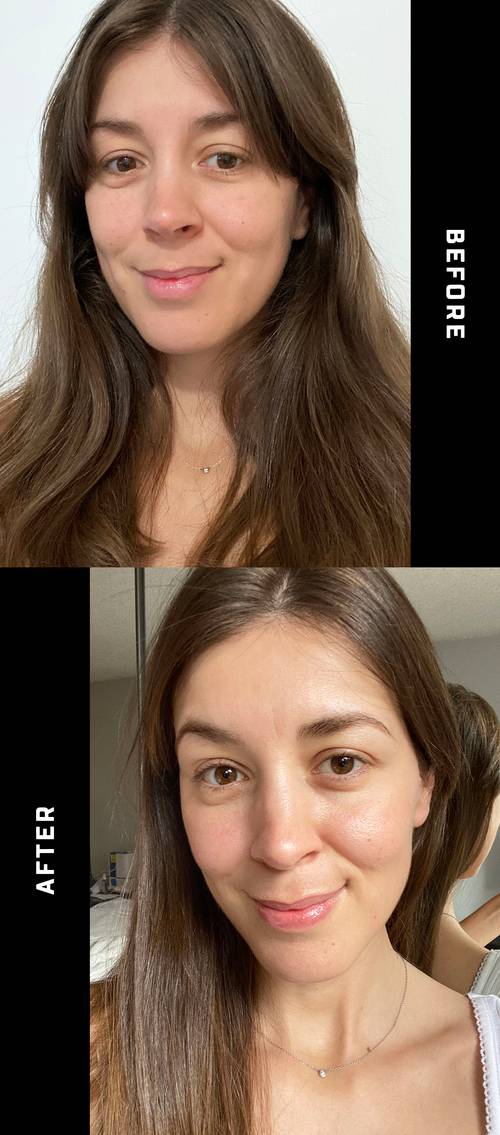 Sự thay đổi của làn da khi chăm dùng vitamin C mỗi ngày-3