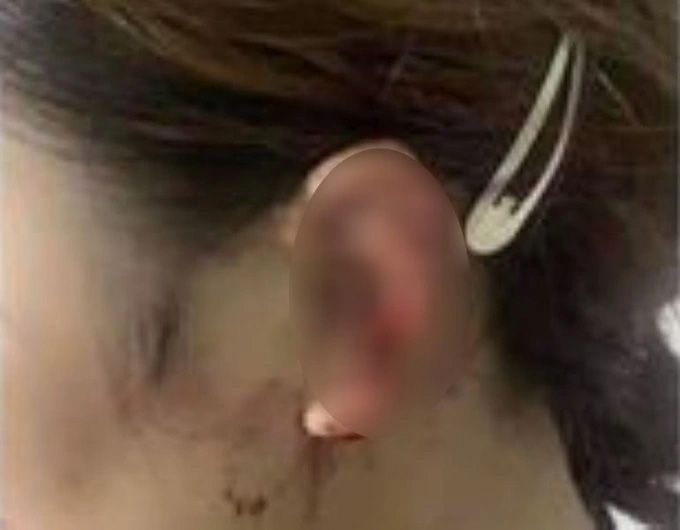 Vụ người phụ nữ đạp vỡ kính ô tô nghi đánh ghen: Có thể đối diện 3 tội danh-2