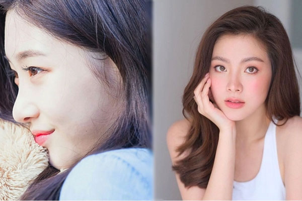 Nâng mũi, cô gái ở Vĩnh Long bị nhiễm trùng lòi cả sống mũi-2