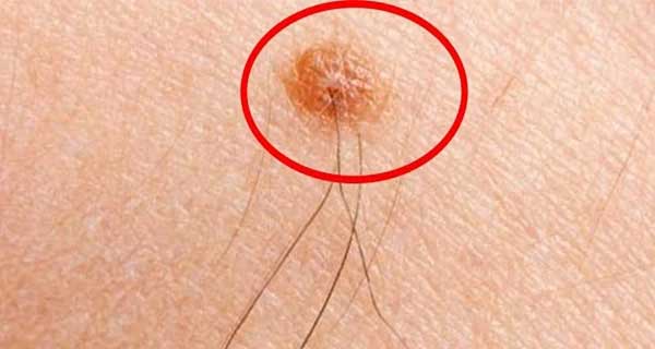 Thầy tướng số nói: Người có lông mọc nhiều ở 1/5 chỗ này rất giàu, phúc lộc phủ phê không cần lo nghĩ-1