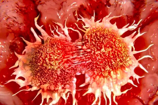 3 loại ung thư hôn nhân: Khi một người mắc thì nửa kia cần được tầm soát càng sớm càng tốt-1