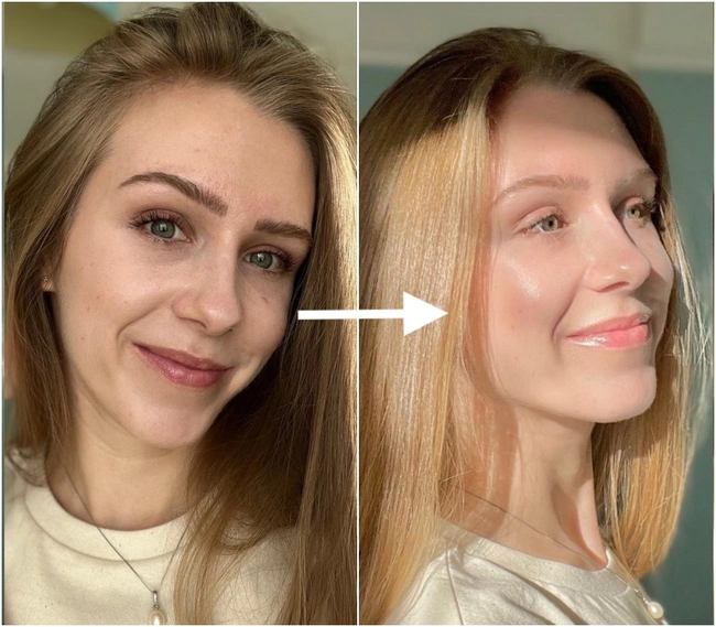 Chống lão hóa tuổi 30+: Bước chăm sóc then chốt bác sĩ khuyên nên làm đủ 365 ngày/ năm-2