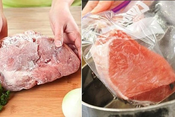 Bé gái bị tụ máu vùng kín phải cấp cứu chỉ vì ngồi sai tư thế khi đi vệ sinh-3