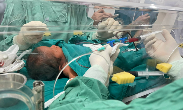 Bé 3 ngày tuổi bất đồng nhóm máu với mẹ, phải thay máu hoàn toàn-1