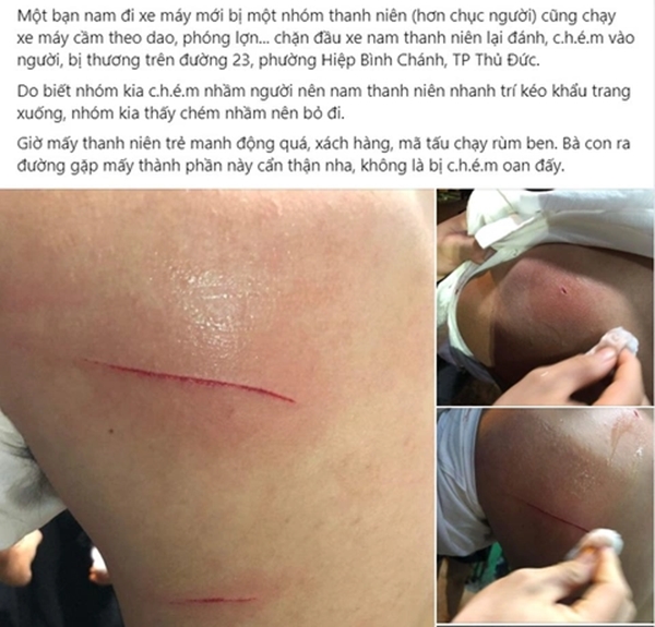 Xác minh vụ nam thanh niên bị chém nhầm ở TP Thủ Đức-1
