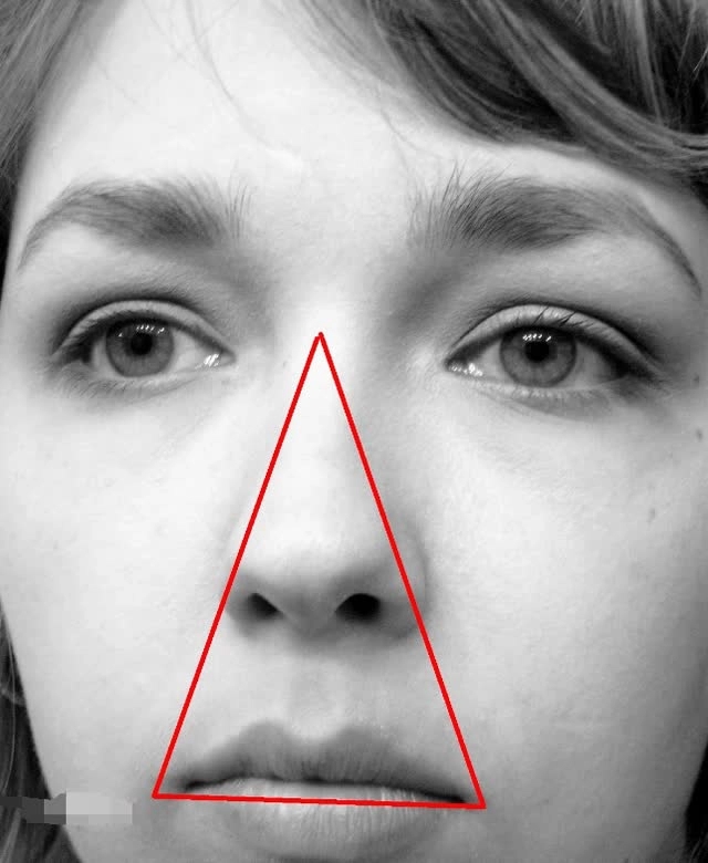 Nặn mụn ở mũi, thiếu niên bị viêm màng não do nhiễm trùng-3