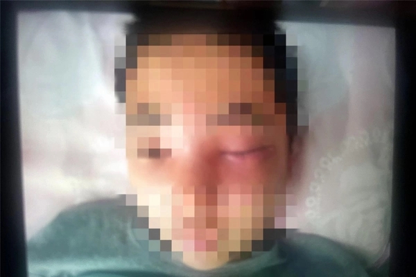 Dấu hiệu quan trọng để phát hiện sớm trẻ mắc viêm màng não-2