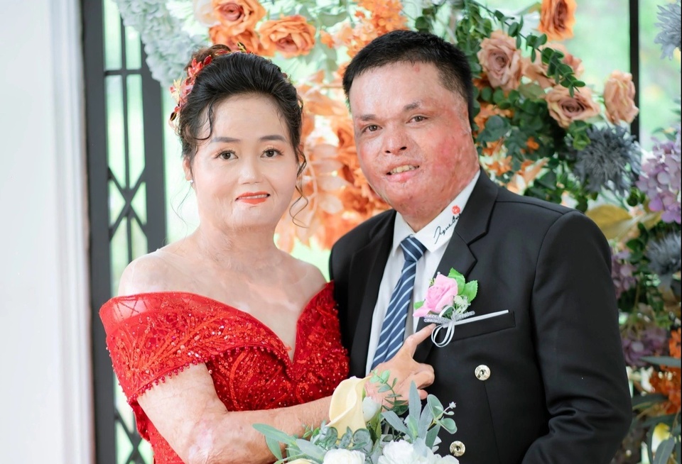 Hạnh phúc mới của người từng bị chồng cũ thiêu sống-1