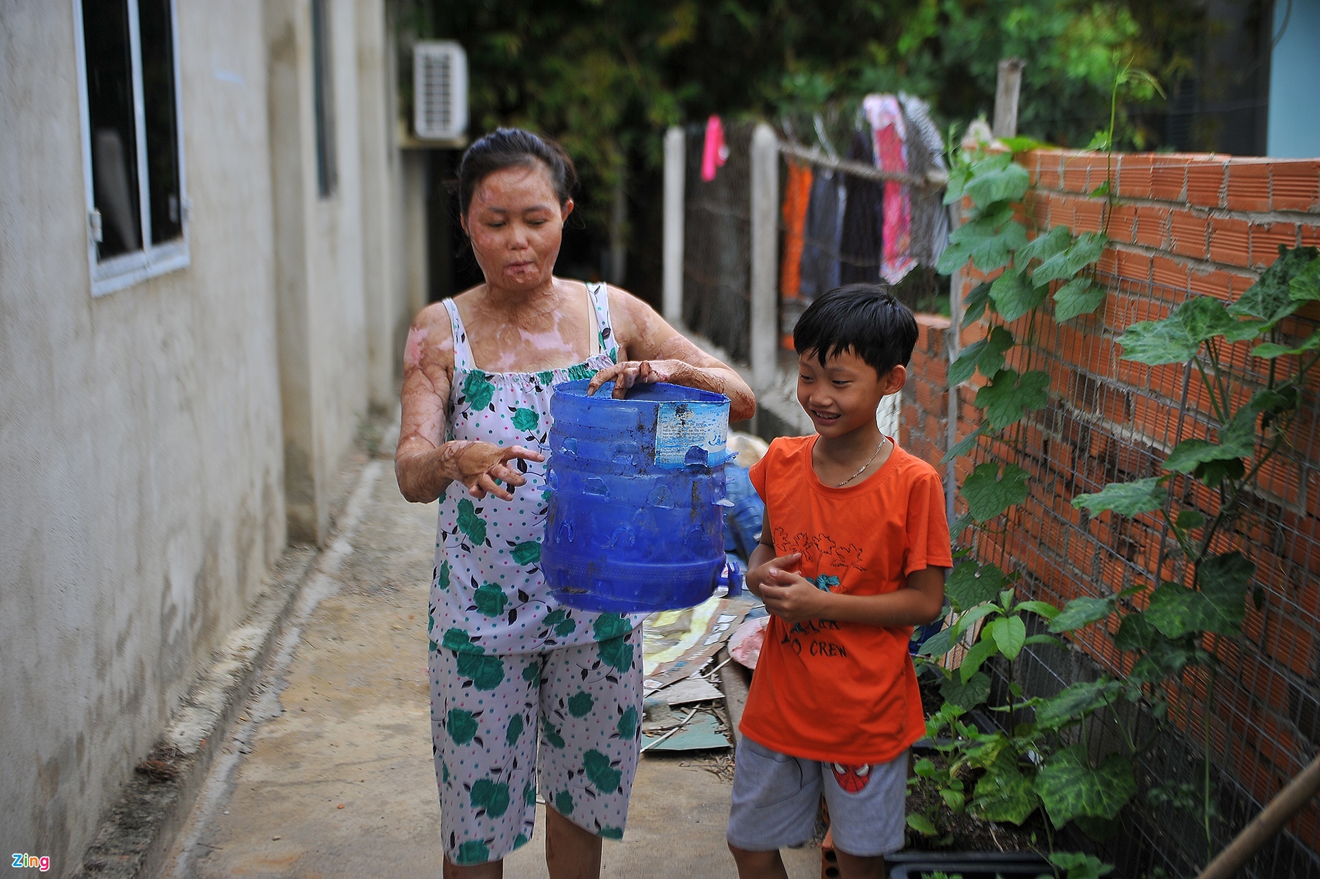 Hạnh phúc mới của người từng bị chồng cũ thiêu sống-5