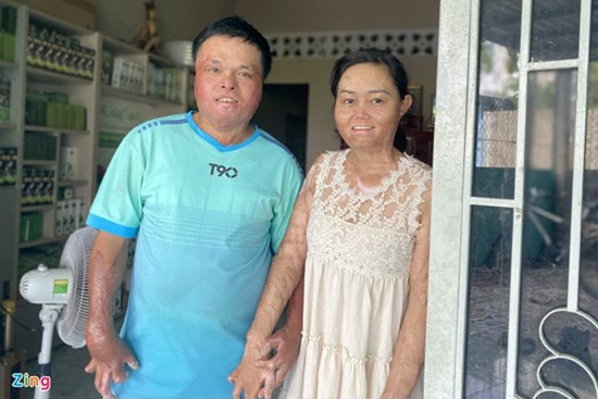 Hạnh phúc mới của người từng bị chồng cũ thiêu sống