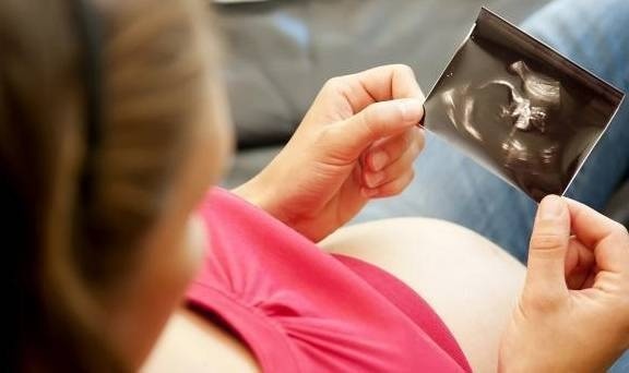 2 kiểu phụ nữ mang thai có xác suất sinh con bị bệnh Down cao, muốn tránh cần làm những xét nghiệm cần thiết-1