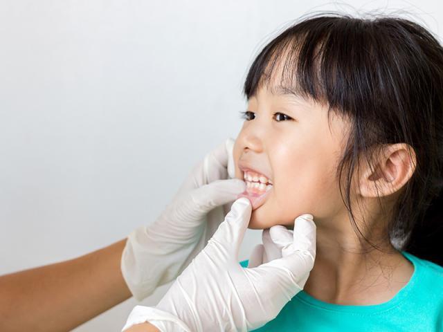 6 sai lầm cha mẹ dễ mắc phải khi chăm sóc răng miệng cho con-4