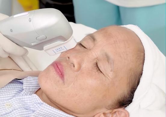 Bà Tân Vlog lộ diện sau thẩm mỹ, mặt đơ cứng không nhận ra-3