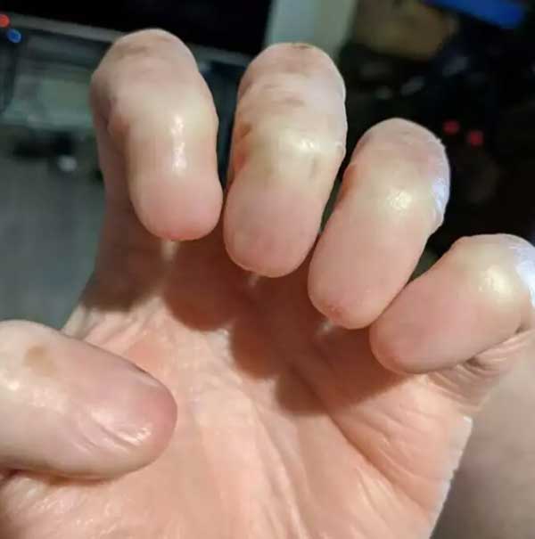 Dị nhân tay không có móng, không dấu vân tay-1