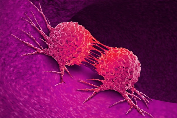 Nhiều người nhầm căn bệnh này với viêm họng, có 5 triệu chứng dưới đây phải đi khám ngay-1