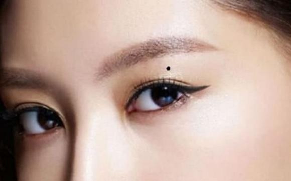 Trên mặt bỗng nhiên xuất hiện những nốt ruồi này, cẩn thận kẻo xui xẻo-1
