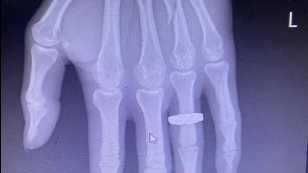 Lời kể của nhân chứng vụ hành khách bị đánh gãy tay vì đòi xuống xe-3