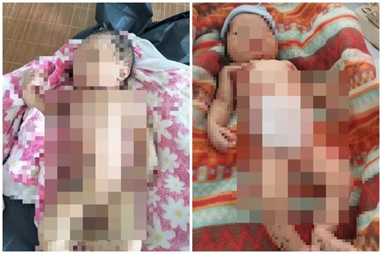 Quảng Nam: Xót xa bé sơ sinh bị bỏ rơi giữa rừng, giòi bám đầy người