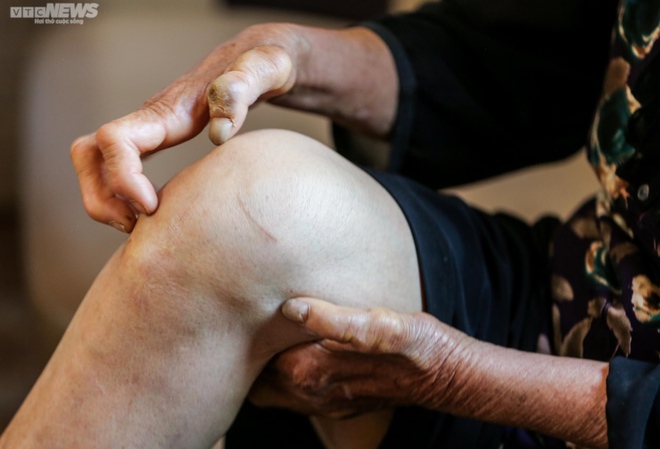 Người phụ nữ cuối cùng ở trại phong Đá Bạc-5