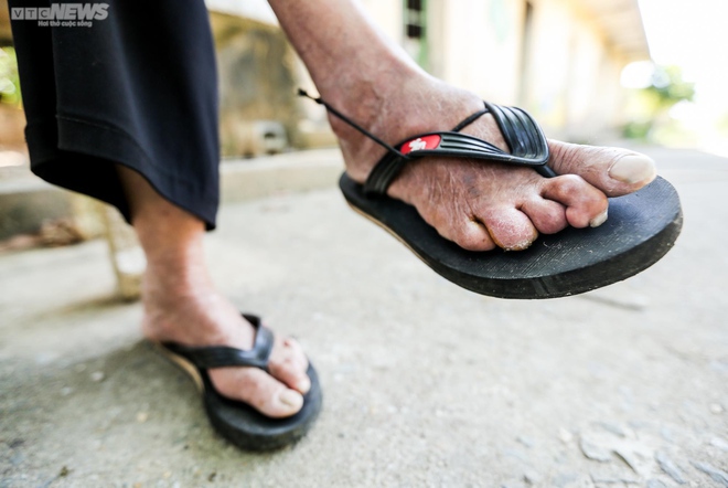 Người phụ nữ cuối cùng ở trại phong Đá Bạc-16