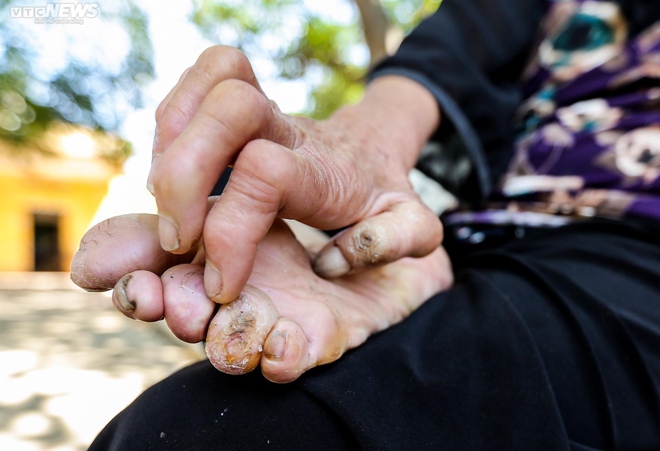 Người phụ nữ cuối cùng ở trại phong Đá Bạc-17