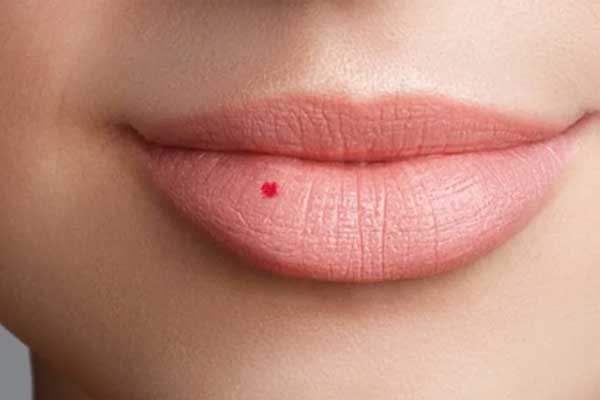 4 nốt ruồi phú quý được Thần Phật đánh dấu: Chỉ cần có 1 thôi cũng đã đủ giàu sang, tiền tình đỏ chót-5