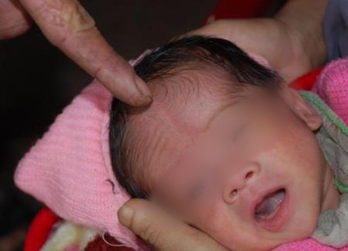 2 bộ phận của trẻ nhỏ rất mỏng manh, mẹ đừng tùy tiện chạm vào-2