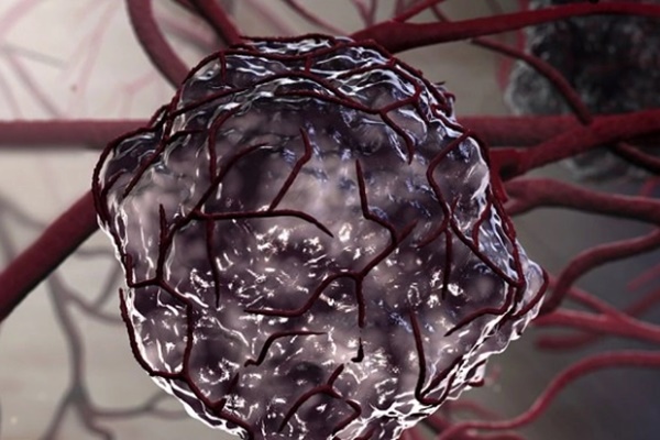 4 cảm giác kỳ lạ trên cơ thể là dấu hiệu bạn đang mắc ung thư mà không biết-1