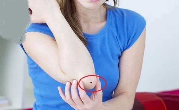 4 nốt ruồi phú quý được Thần Phật đánh dấu: Chỉ cần có 1 thôi cũng đã đủ giàu sang, tiền tình đỏ chót-3