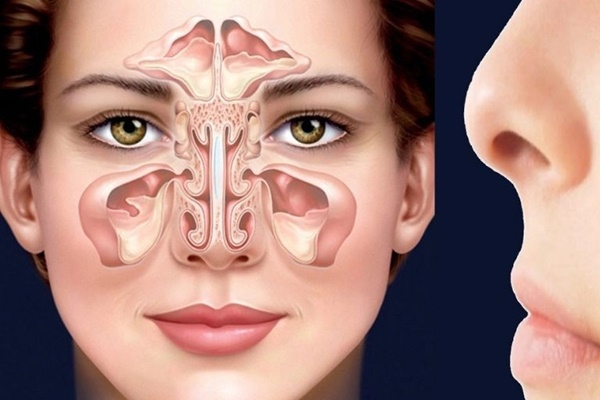 Những thảo dược chữa bệnh viêm xoang Những thảo dược chữa bệnh viêm xoang