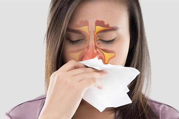 Người viêm mũi dị ứng có 2 món không ăn - 3 món ăn nhiều để không khiến bệnh thêm trầm trọng-1