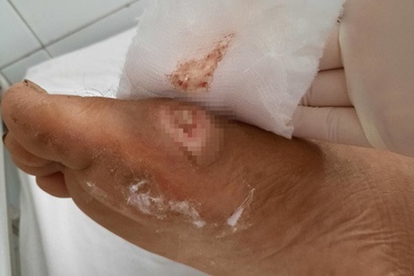 3 người bất ngờ phát hiện mắc bệnh Whitmore, có bé suy tạng phải thở máy-1