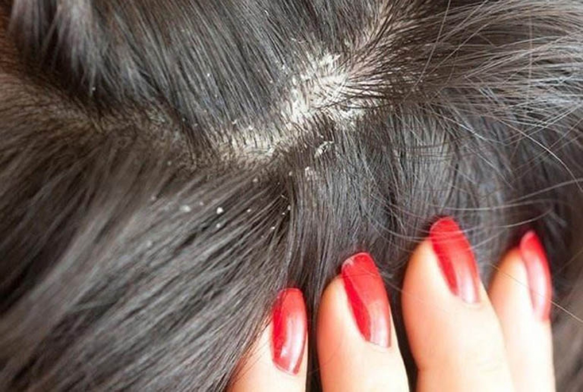 Những thói quen gây hư tổn tóc, bạn đã biết chưa?-3