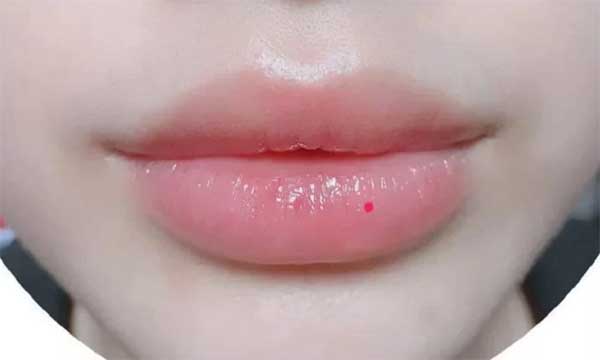 6 nốt ruồi tượng trưng cho Tài - Lộc - Phát, quý hơn vàng mười: Có 1/6 đủ hưởng lộc cả đời-2