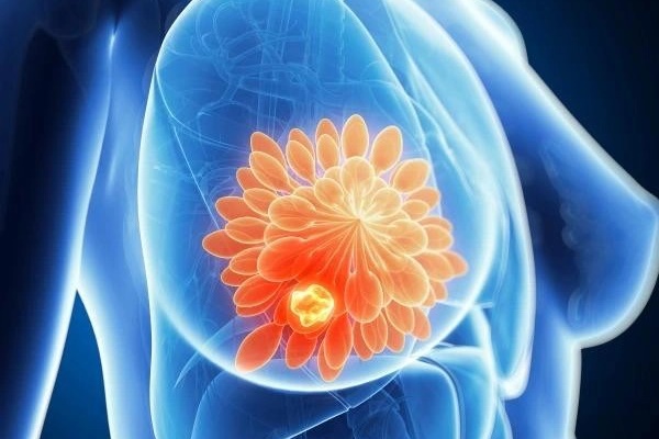 Kích thước vòng một và những lầm tưởng phổ biến về ung thư vú-2